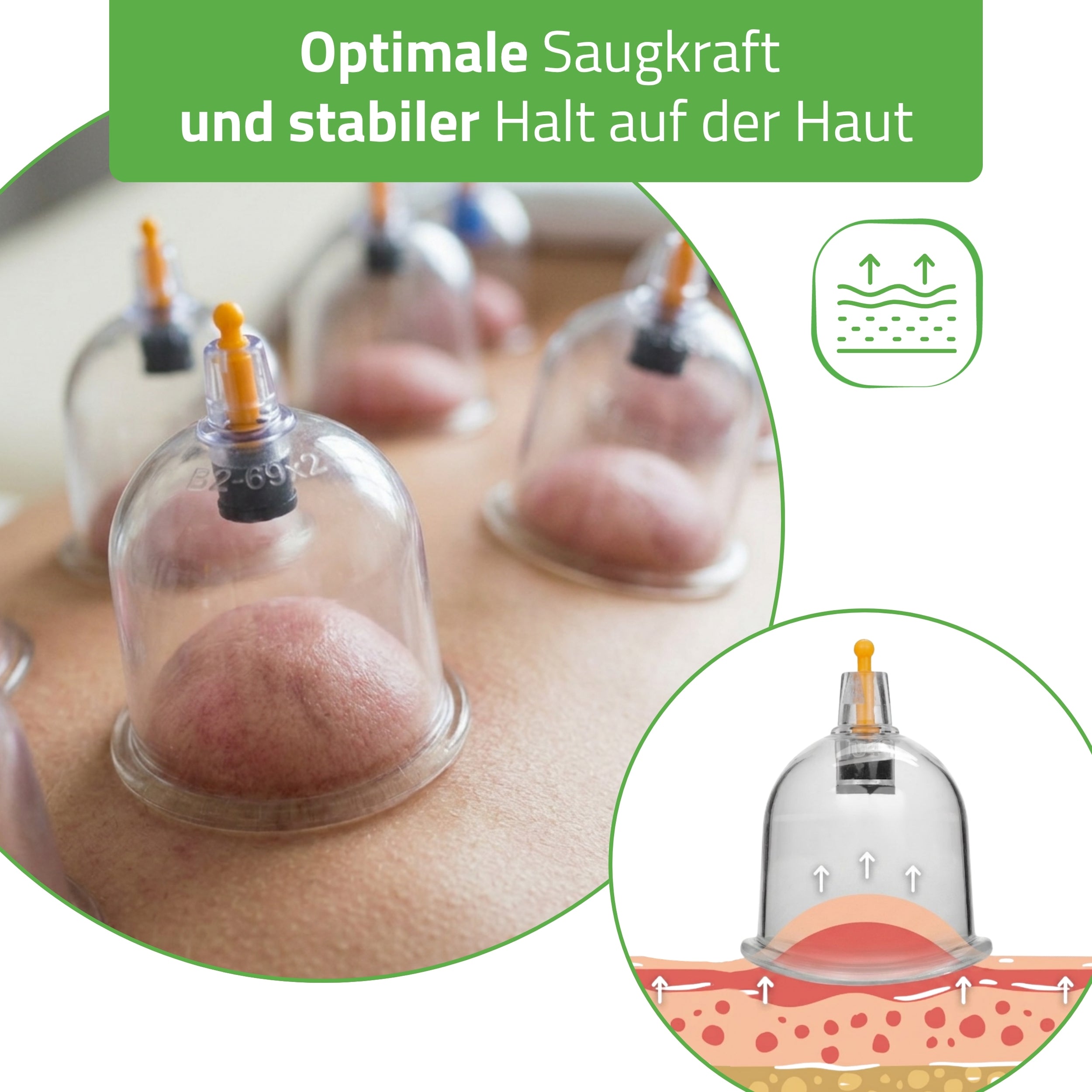 habys-vakuum-schr-pfk-pfe-mit-pumpe-feuerloses-schr-pfset-14-st-ck image 7